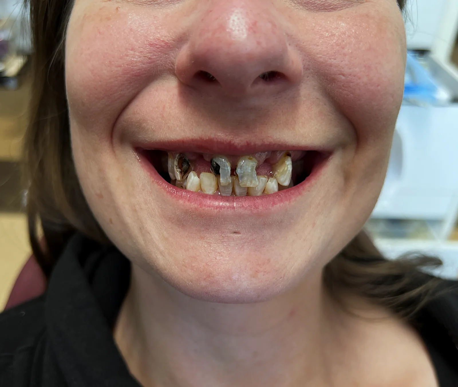 Case 11, before